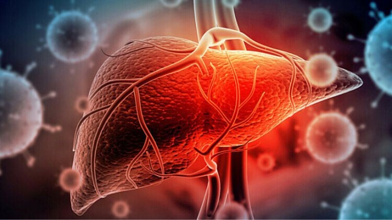 Nếu mắc bệnh hemochromatosis thì nên đi tầm soát ung thư gan sớm 