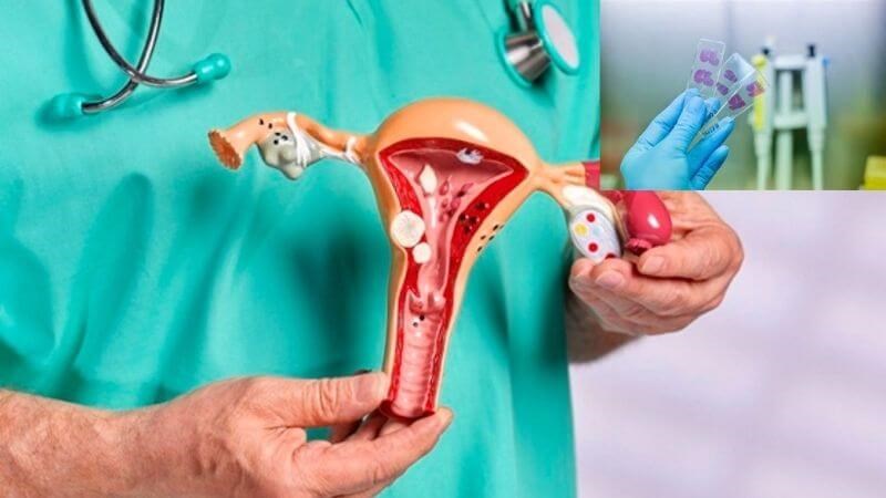 Sinh thiết nội mạc tử cung để đánh giá các tế bào sâu trong tử cung