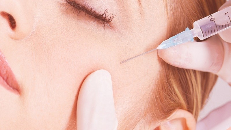 Botox có thể khiến độc tố xâm nhập vào cơ kiểm soát mí mắt trên gây sụp mí