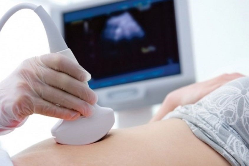 Mẹ đi siêu âm khi thử thai 2 vạch và trễ kinh từ 7 đến 15 ngày