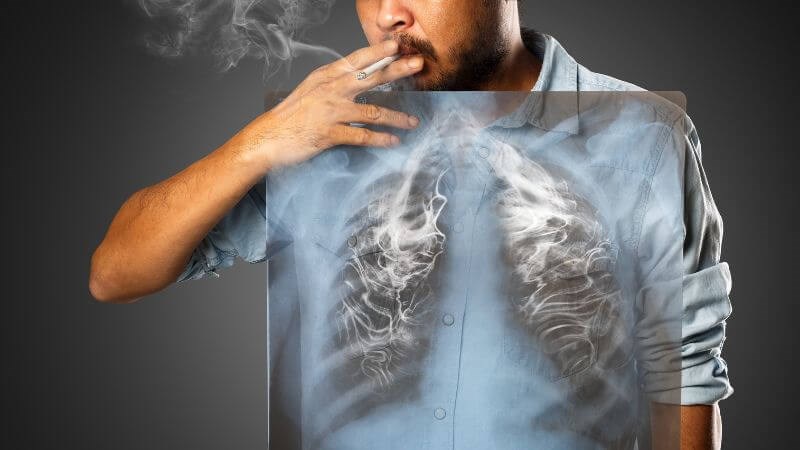 Thuốc lá là nguyên nhân hàng đầu gây ung thư phổi