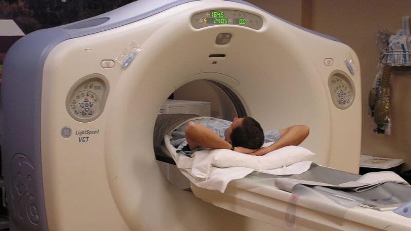 Chụp cắt lớp vi tính giúp chẩn đoán ung thư phổi