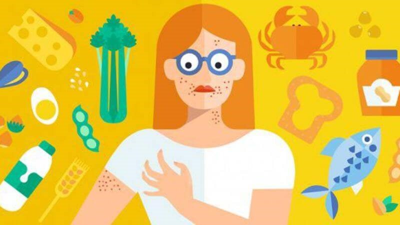 Dị ứng thực phẩm là một trong những nguyên nhân gây nên mề đay