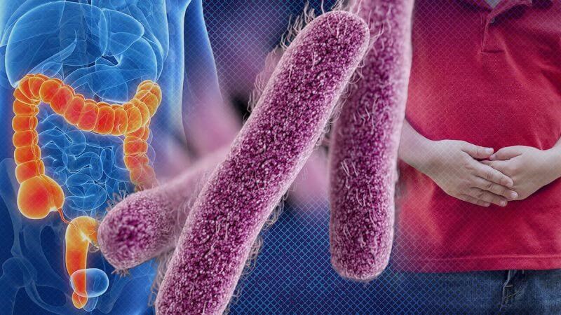 Vi khuẩn Shigella là nguyên nhân dẫn đến viêm dạ dày ruột