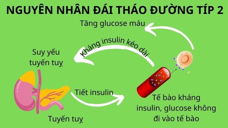 Kháng insulin là nguyên nhân gây nên đái tháo đường típ 2 Kháng insulin là nguyên nhân gây nên đái tháo đường típ 2