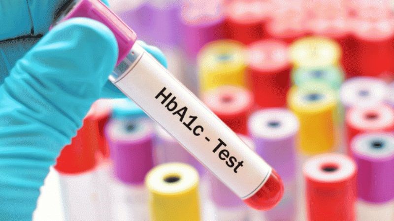 Xét nghiệm HbA1c là chỉ số tin cậy chẩn đoán đái tháo đường Xét nghiệm HbA1c là chỉ số tin cậy chẩn đoán đái tháo đường