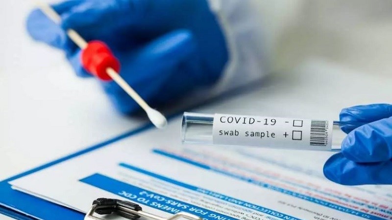 Xét nghiệm PCR cho kết quả chính xác cao