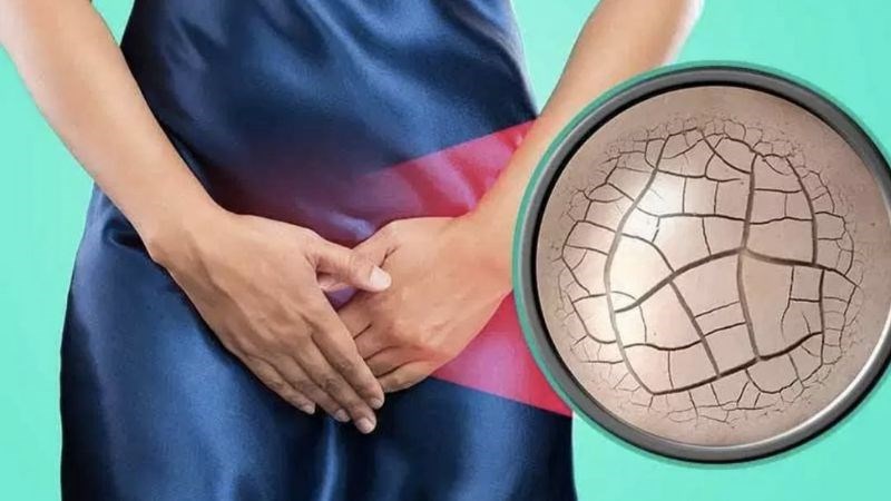 Khô âm đạo là dấu hiệu của tiền mãn kinh