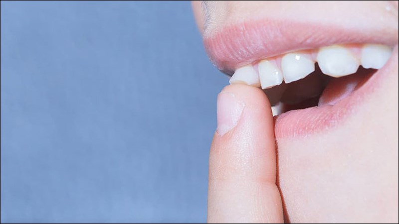 Răng lung lay có thể do gặp vấn đề ở nướu