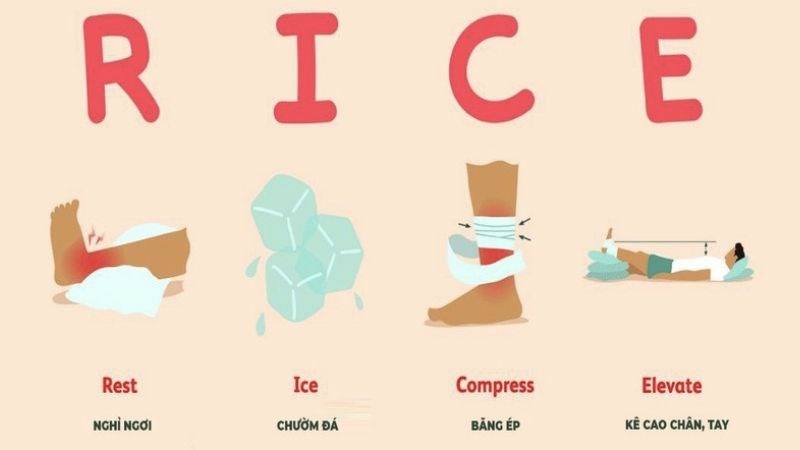 Liệu pháp R.I.C.E giúp giảm đau khớp gối