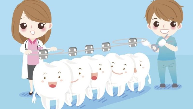 Thực hiện chỉnh nha khi răng khấp khểnh để hạn chế tụt lợi