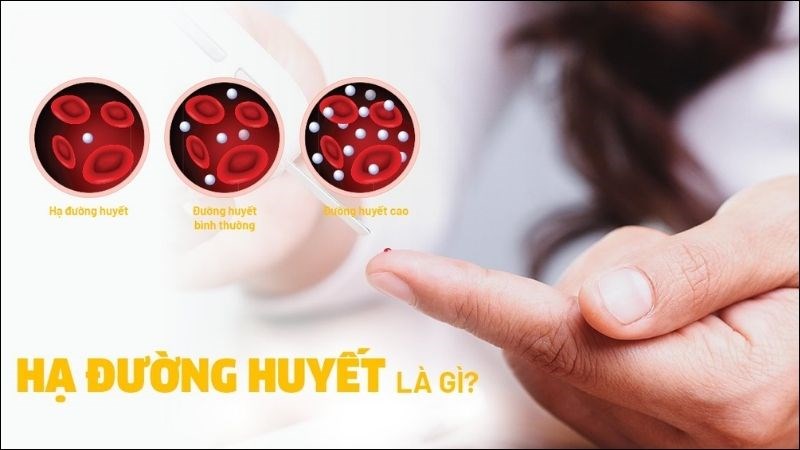 Hạ đường huyết là tình trạng lượng đường trong máu giảm xuống mức quy định