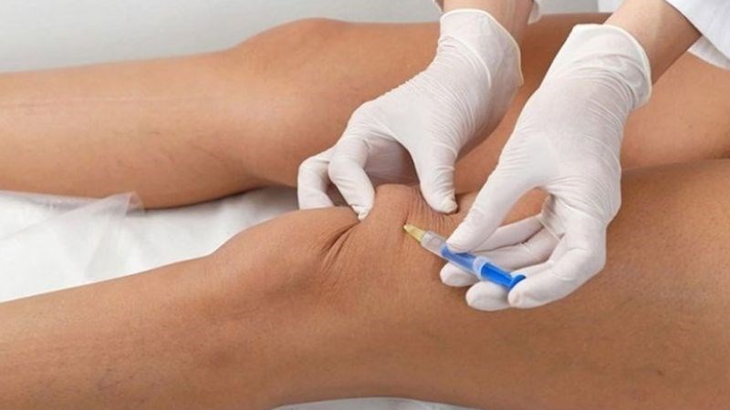 Liệu pháp sinh học giúp giảm hoạt động của tế bào miễn dịch, hỗ trợ giảm sưng tấy