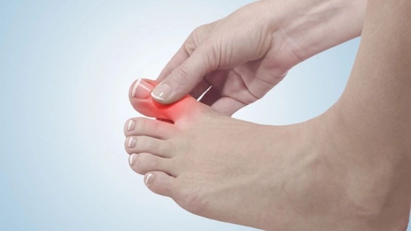 Sưng ngón chân là tình trạng ngón chân to hơn so với bình thường