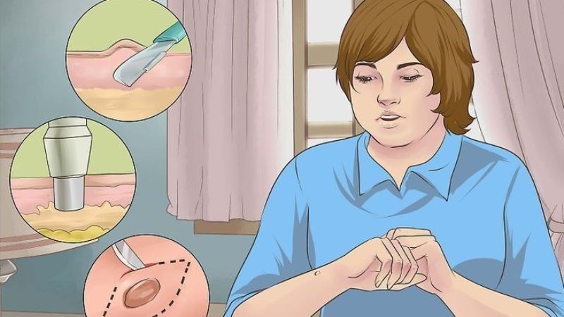 Khi không chắc chắn về chẩn đoán lâm sàng bác sĩ có thể yêu cầu sinh thiết da