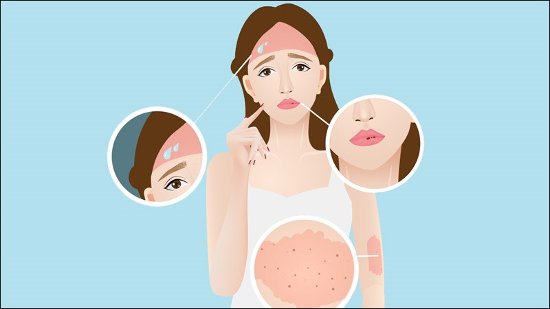 Lupus ban đỏ biểu hiện triệu chứng ở nhiều cơ quan