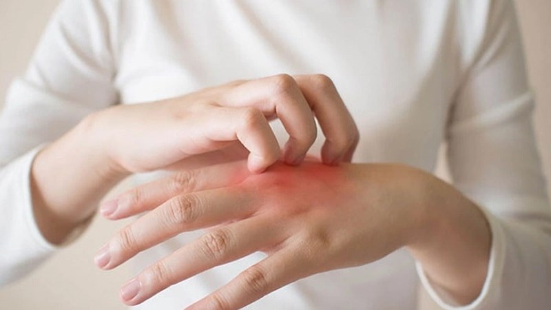 Viêm khớp dạng thấp có thể khến người bệnh mất ngủ