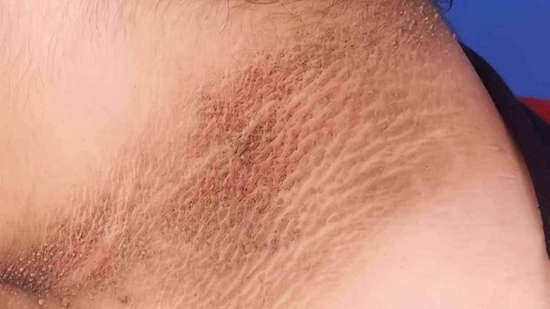 Khi có thay đổi sắc tố trên da nên đến gặp bác sĩ