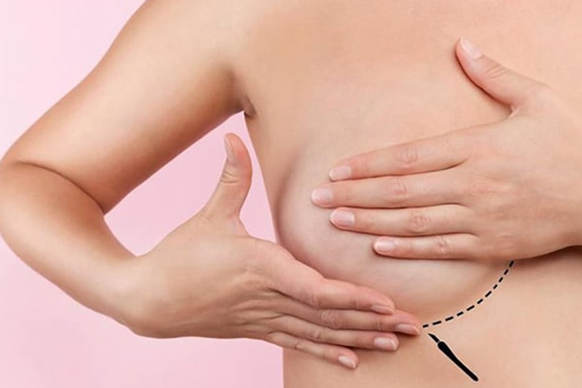 Có nhiều phương pháp massage kích sữa sau sinh ngay tại nhà