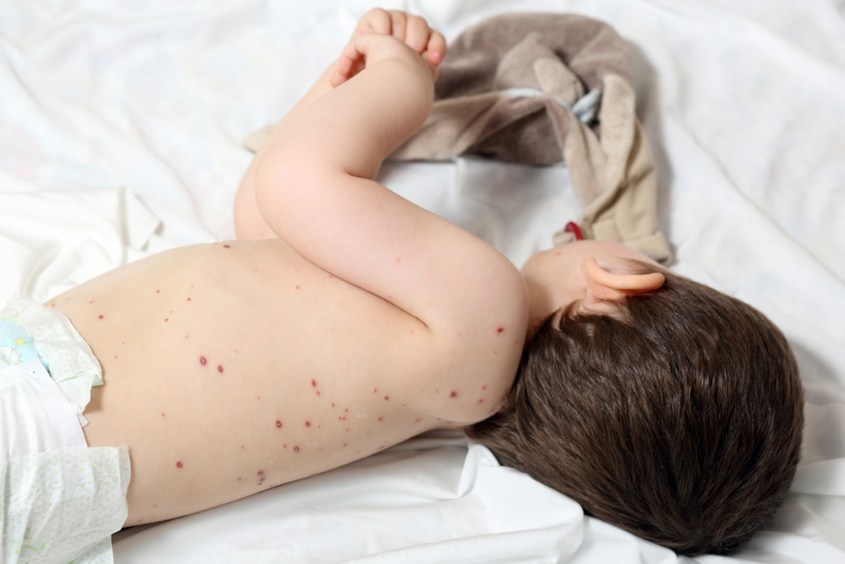 Nên cách ly trẻ từ 7 - 10 ngày