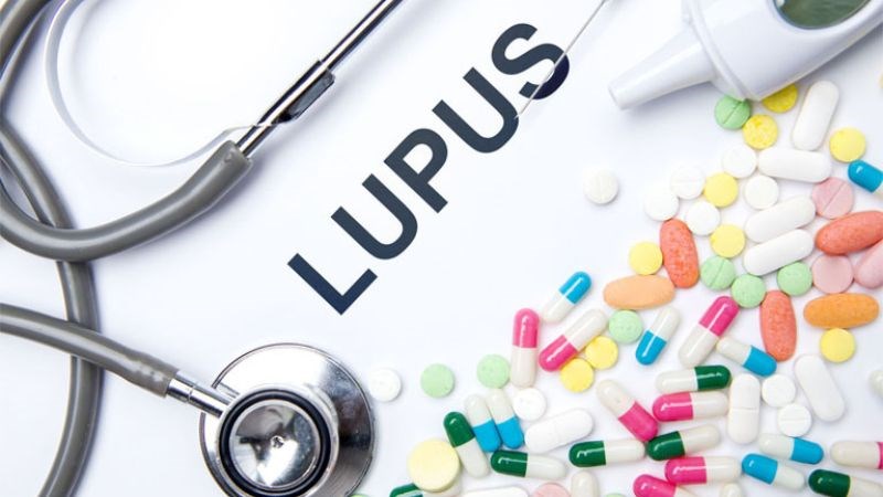 Chữa bệnh lupus chủ yếu dựa vào các thuốc để điều trị triệu chứng của bệnh