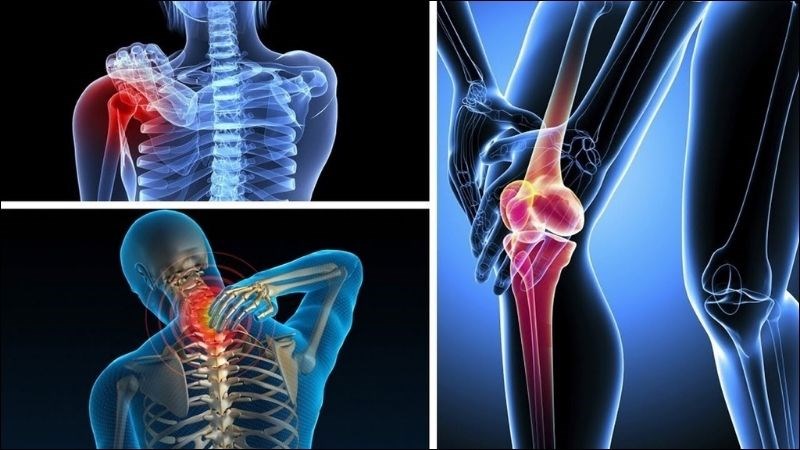 Sưng đau các khớp tái diễn là một trong các triệu chứng của bệnh lupus ban đỏ