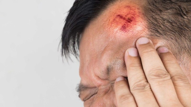 Chấn thương đầu là một trong những nguyên nhân gây động kinh