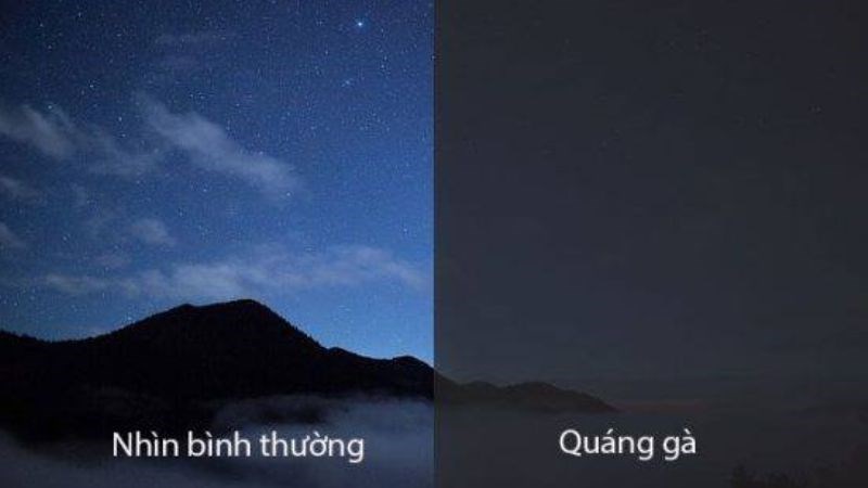 Quáng gà là một trong những bệnh lý ở mắt liên quan đến thiếu vitamin A
