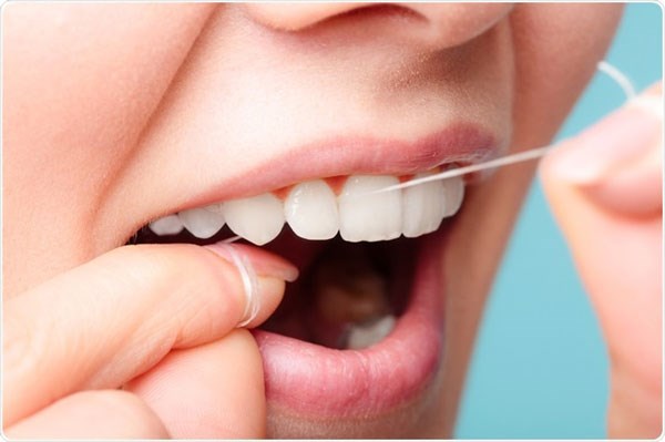 Bạn có thể sử dụng chỉ nha khoa để làm sạch răng và loại bỏ mảng bám