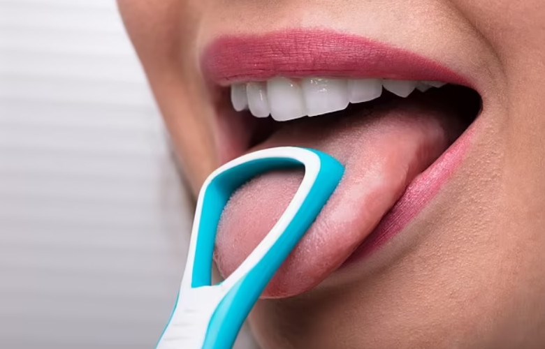 Bạn có thể cạo lưỡi với các dụng cụ chuyên dụng để loại bỏ vi khuẩn, làm giảm hôi miệng