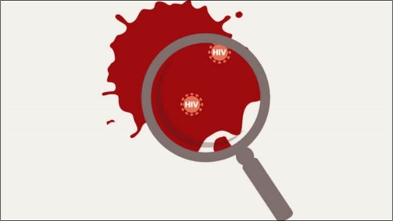Thực hiện các xét nghiệm để kiểm tra tải lượng virus HIV có trong tinh trùng