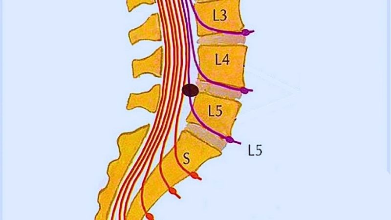 Thần kinh tọa được tạo nên bởi các rễ thần kinh từ đốt sống thắt lưng L3, L4, L5, S1