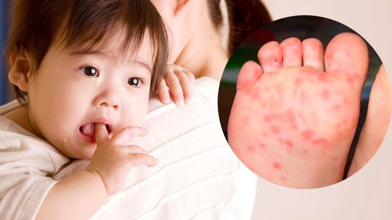 Bệnh tay chân miệng  là một căn bệnh phổ biến và ảnh hưởng nghiêm trọng đến trẻ em