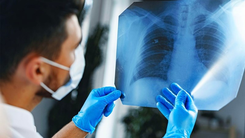 Một số nghiên cứu đã phát hiện ra rằng vải có thể phòng chống ung thư phổi