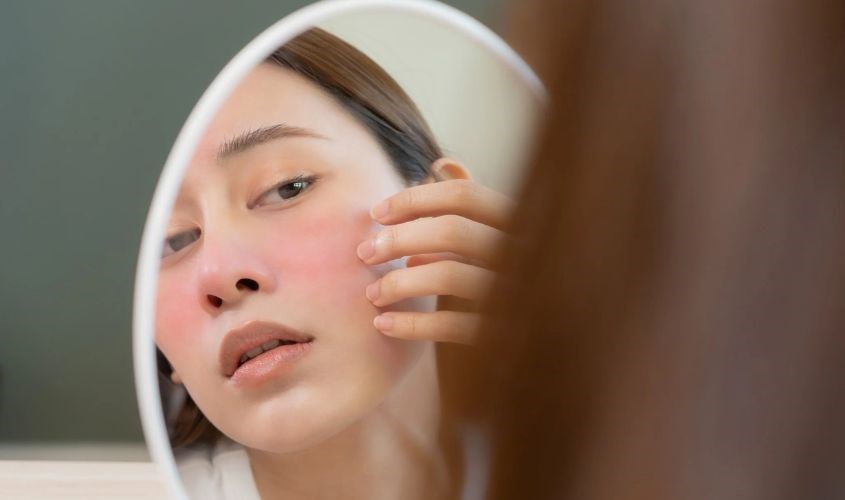 Da chưa quen với retinol có thể gây dị ứng khi dùng Da chưa quen với retinol có thể gây dị ứng khi dùng