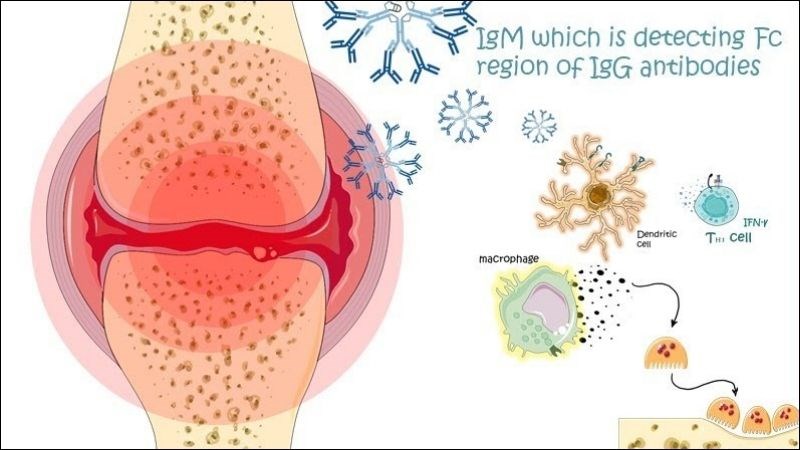 Tình trạng đau viêm khớp được cải thiện khi giảm cân