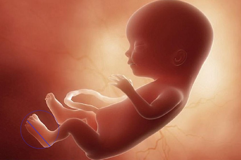 Chiều dài bàn chân thai nhi 21 tuần khoảng 26 mm Chiều dài bàn chân thai nhi 21 tuần khoảng 26 mm