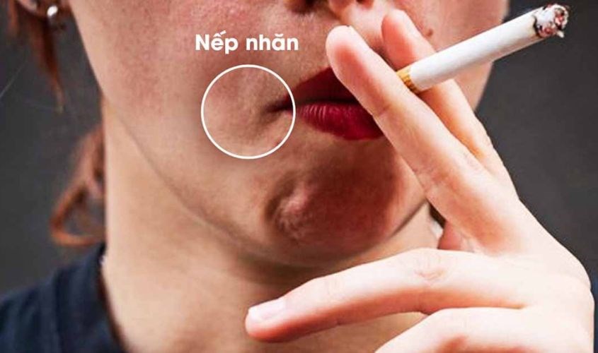 Trong thuốc lá có chứa nicotin làm cho da lão hóa