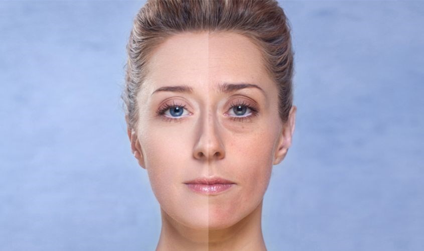 Theo thời gian, da sẽ dần bị xỉn màu