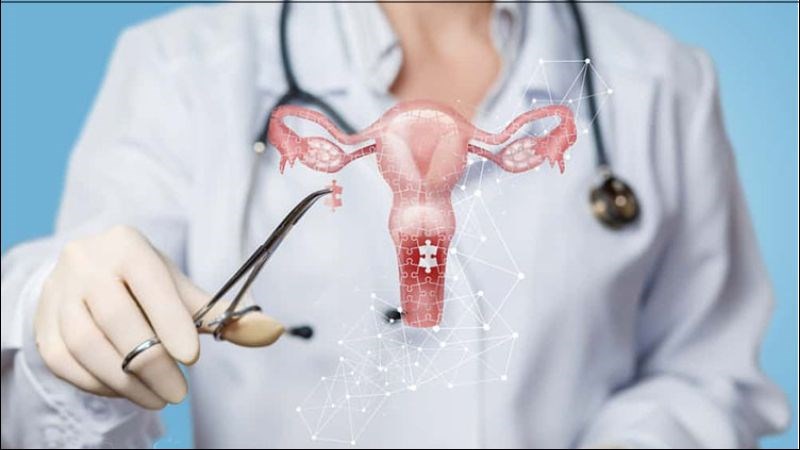 Nên tiếp tục sàng lọc trong 20 năm tiếp theo tính từ thời điểm phẫu thuật