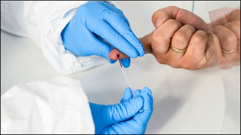 Xét nghiệm chích da giúp kiểm tra dị ứng với tinh dịch
