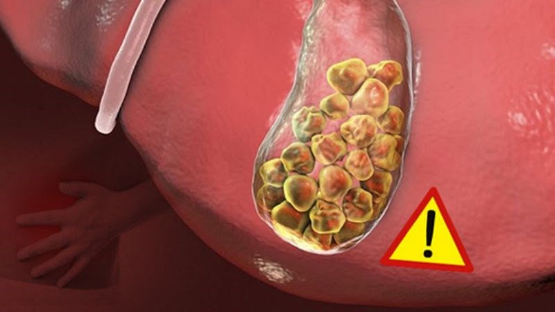 Nhân trần có tác dụng vô cùng hiệu quả trên các bệnh về gan, mật.