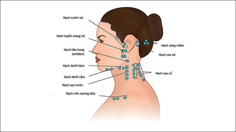 Hạch bạch huyết có ở nhiều nơi trên khắp cơ thể tạo nên hệ thống bạch huyết