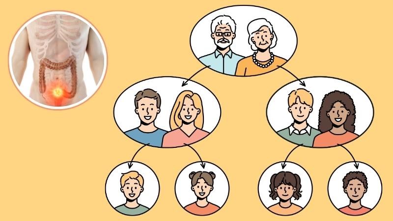 Người có tiền sử gia đình mắc ung thư đại tràng nên được tầm soát ung thư đại tràng