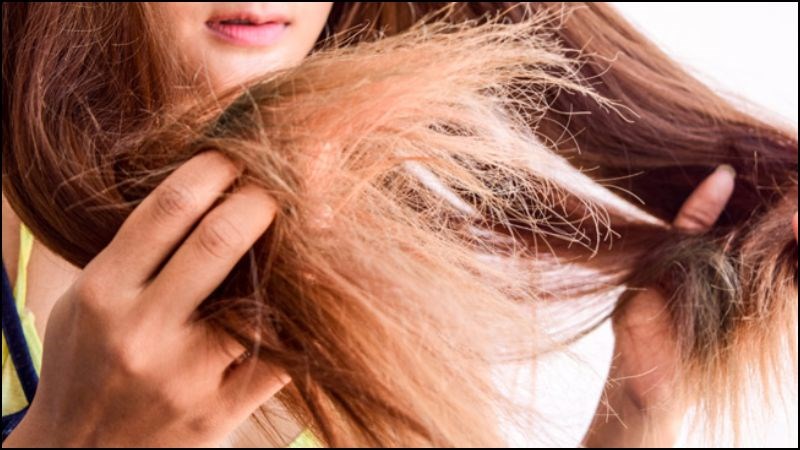 Cơ thể thiếu đồng sẽ khiến tóc trở nên yếu ớt và dễ gãy rụng