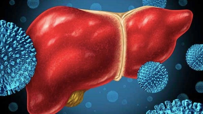 Viêm gan B có thể dẫn đến biến chứng nguy hiểm ung thư tế bào gan