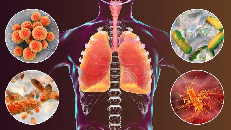 Viêm phổi là một biến chứng nặng của sốt siêu vi