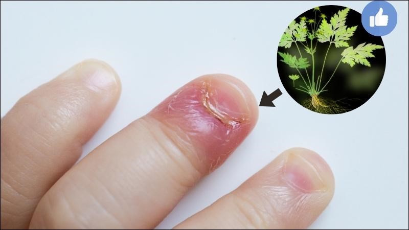 Hoàng liên có thể được sử dụng để điều trị một số tình trạng viêm