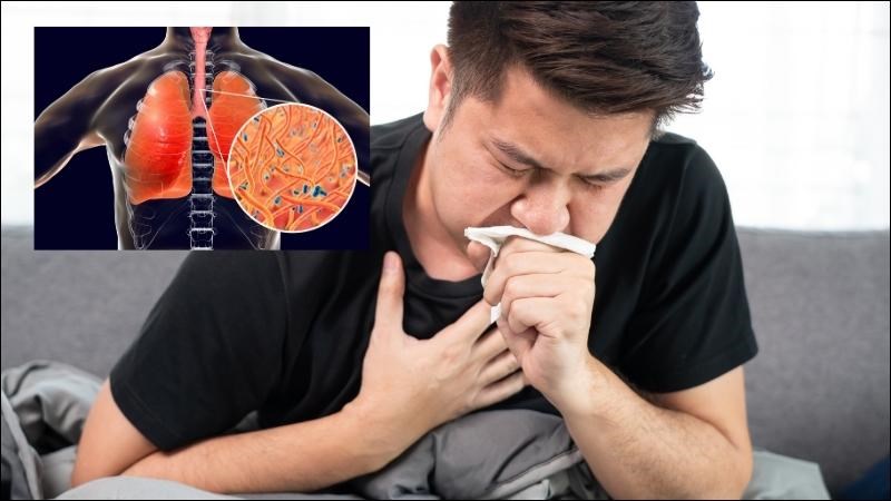 Có thể sử dụng Hoàng liên để phòng ngừa bệnh ho gà