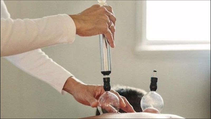 Bơm chuyên dụng được sử dụng để tạo áp suất âm trong cốc giác